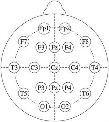 An Interpretable Machine Learning Method for the Detection of Schizophrenia Using EEG Signals